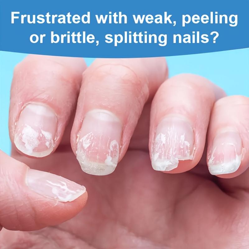 Cleanixy 3 Days Nail Care-Visible Nail Repair in Just 3 Days
