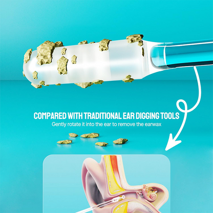 🏆Flash Sale⚡ 50K+ SOLD!-Ear cleanner Sticky Pick